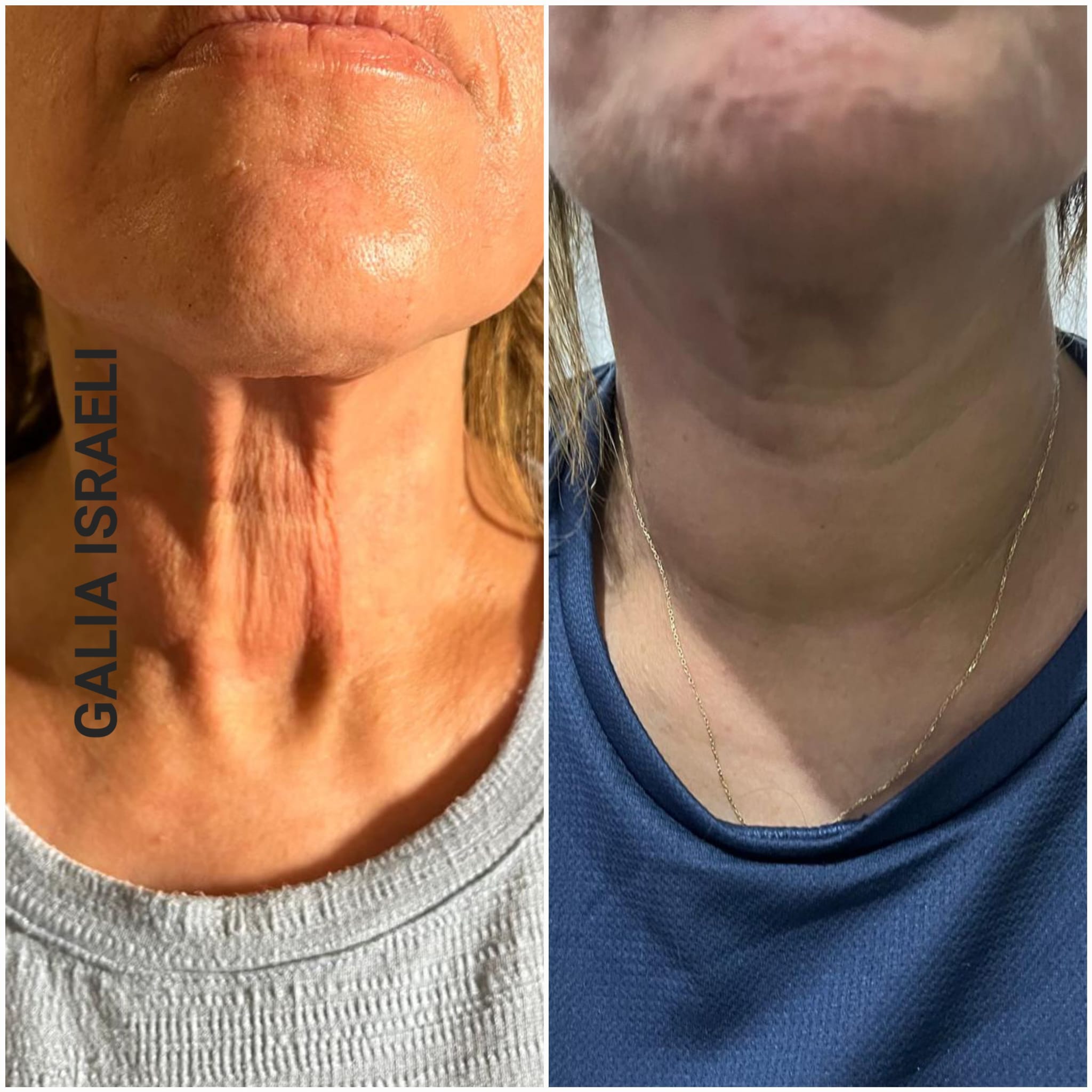 WhatsApp Image 2026-01-22 at 12.53.37 (2)